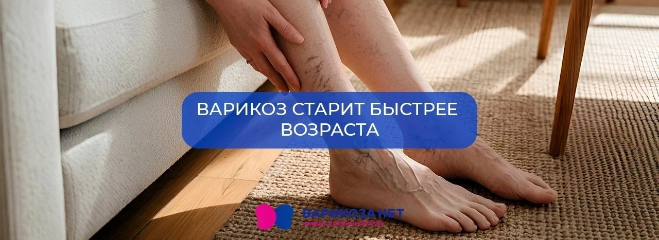 Варикоз старит быстрее возраста