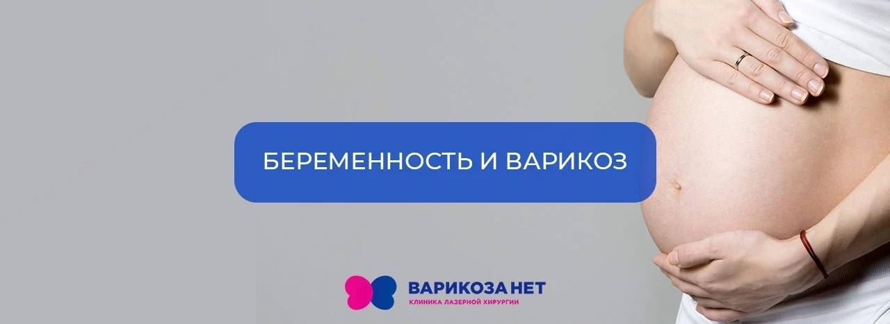 Варикоз после беременности: важно знать!